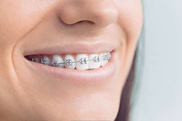 Dental Inlays and Onlays in Roseland, LA